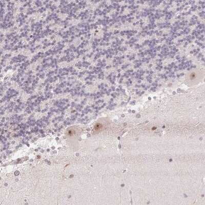 Immunohistochemistry: JMJD2D Antibody [NBP2-49411]