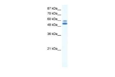 Western Blot: JMJD2D Antibody [NBP2-87644]