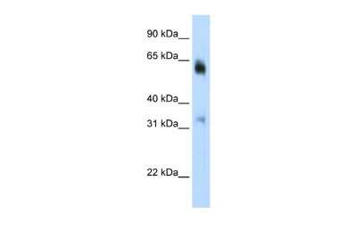 Western Blot: JMJD2D Antibody [NBP2-87645]