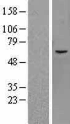 Western Blot: JMJD2D Overexpression Lysate [NBL1-12105]