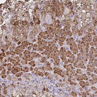 Immunohistochemistry: JMJD4 Antibody [NBP2-38680]