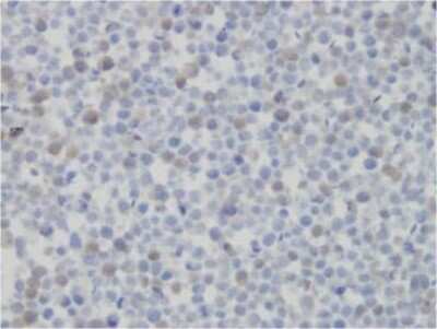 Immunohistochemistry: JMJD4 Antibody (JMJD4/32b/H12) - BSA Free [NBP2-50425]