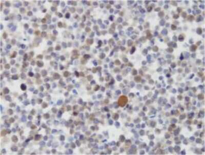 Immunohistochemistry: JMJD4 Antibody (JMJD4/32b/H12) - BSA Free [NBP2-50425]