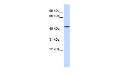 Western Blot: JMJD4 Antibody [NBP2-87647]