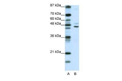 Western Blot: JMJD4 Antibody [NBP2-87649]