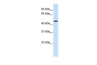 Western Blot: JMJD5 Antibody [NBP2-82260]