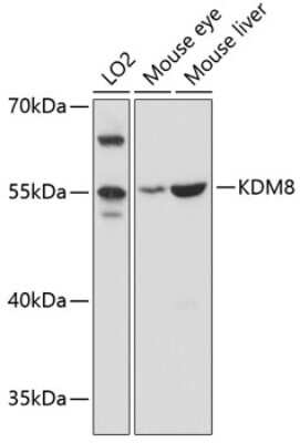 Western Blot: JMJD5 AntibodyAzide and BSA Free [NBP3-03488]