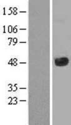 Western Blot: JMJD5 Overexpression Lysate [NBL1-12106]