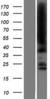 Western Blot: JMJD5 Overexpression Lysate [NBP2-09744]