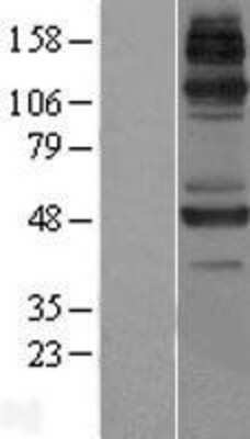 Western Blot: JMJD6/PSR Overexpression Lysate [NBL1-12107]