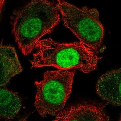 Immunocytochemistry/ Immunofluorescence: JMJD6/PSR Antibody [NBP2-57068]