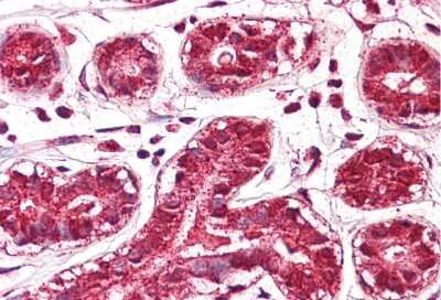 Immunohistochemistry: JMJD6/PSR Antibody [NBP3-10913]