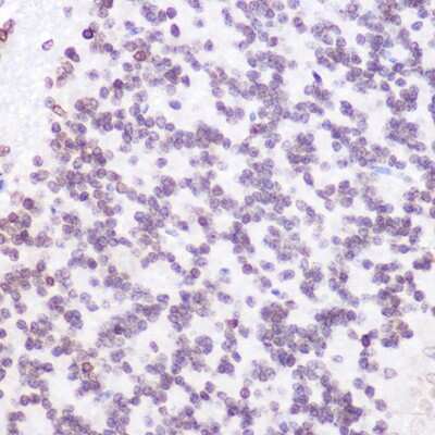 Immunohistochemistry-Paraffin: JMJD6/PSR Antibody - Azide and BSA Free [NBP3-03444]