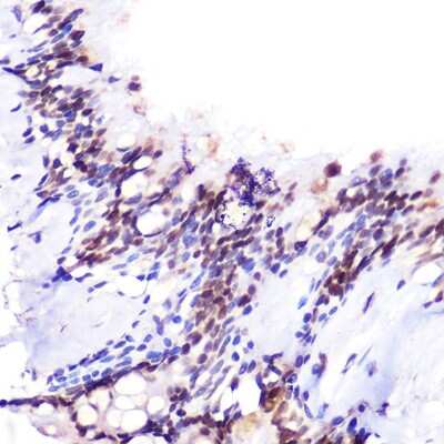 Immunohistochemistry-Paraffin: JMJD6/PSR Antibody - Azide and BSA Free [NBP3-03444]