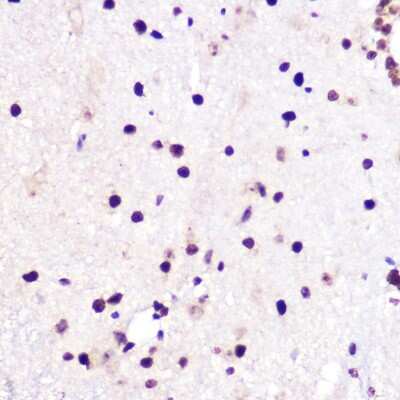 Immunohistochemistry-Paraffin: JMJD6/PSR Antibody - Azide and BSA Free [NBP3-03444]