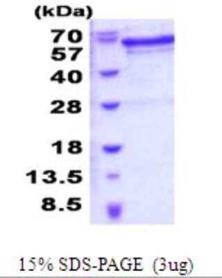 SDS-PAGE: Recombinant Human JMJD6/PSR His Protein [NBP2-52005]