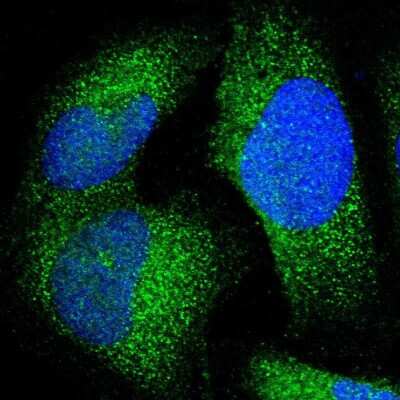 Immunocytochemistry/ Immunofluorescence: JMJD7 Antibody [NBP1-91110]