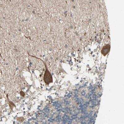 Immunohistochemistry-Paraffin: JMJD7 Antibody [NBP1-91110]