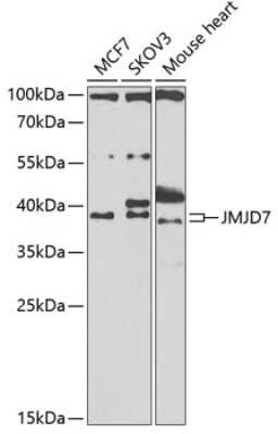 Western Blot: JMJD7 AntibodyBSA Free [NBP3-04670]