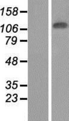 Western Blot: JMJD7 Overexpression Lysate [NBP2-07796]