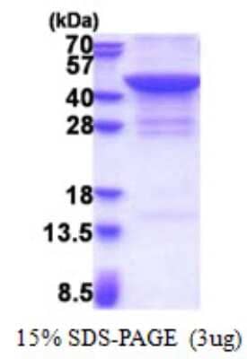 SDS-PAGE: Recombinant Human JMJD7 His Protein [NBP2-23157]