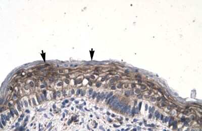 Immunohistochemistry: JMJD8 Antibody [NBP2-86687]