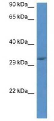 Western Blot: JMJD8 Antibody [NBP1-79715]