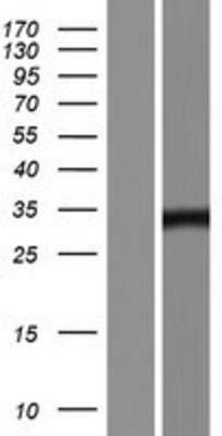 Western Blot: JMJD8 Overexpression Lysate [NBP2-08855]