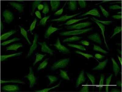 Immunocytochemistry/ Immunofluorescence: JMY Antibody (2D7) [H00133746-M01]