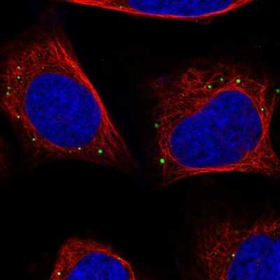 Immunocytochemistry/ Immunofluorescence: JNK/JIP3 Antibody [NBP2-38490]