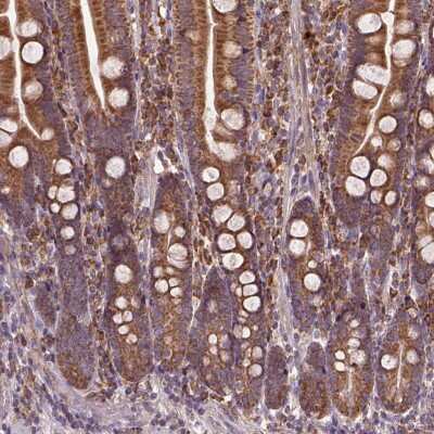 Immunohistochemistry: JNK/JIP3 Antibody [NBP2-49593]