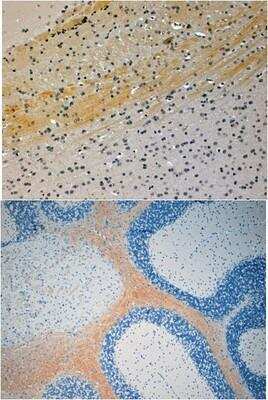 Immunohistochemistry-Paraffin: JNK/JIP3 Antibody [NB100-1246]