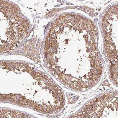 Immunohistochemistry-Paraffin: JNK/JIP3 Antibody [NBP2-38490]