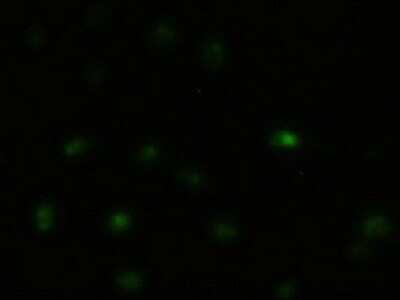 Immunocytochemistry/ Immunofluorescence: JNK1 Antibody (OTI4E3) [NBP1-48284]