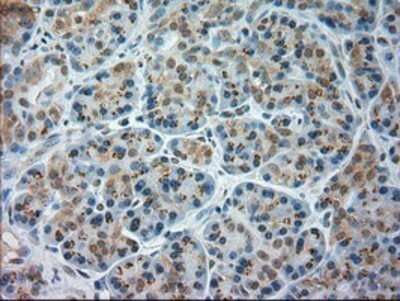 Immunohistochemistry-Paraffin: JNK1 Antibody (OTI4E3) [NBP1-48284]