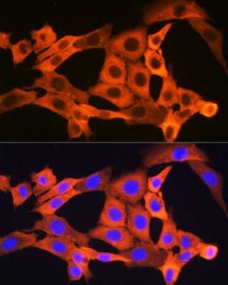 Immunocytochemistry/ Immunofluorescence: JNK1 Antibody (8Q7S4) [NBP3-16536]