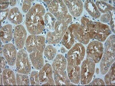 Immunohistochemistry: JNK1 Antibody (OTI4E3) - Azide and BSA Free [NBP2-71256]