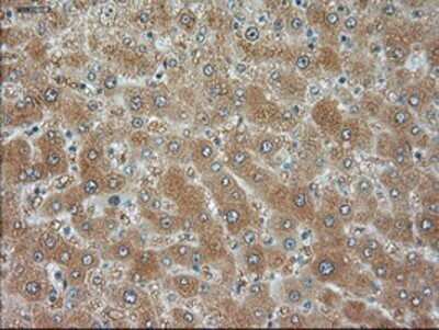 Immunohistochemistry: JNK1 Antibody (OTI4E3) - Azide and BSA Free [NBP2-71256]