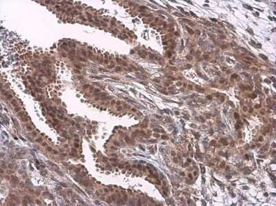 Immunohistochemistry-Paraffin: JNK1/JNK2 Antibody [NBP3-13296]