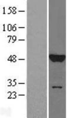 Western Blot: JNK1 Overexpression Lysate [NBL1-12884]