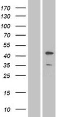 Western Blot: JNK1 Overexpression Lysate [NBP2-04235]