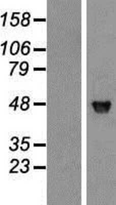 Western Blot: JNK1 Overexpression Lysate [NBP2-05603]