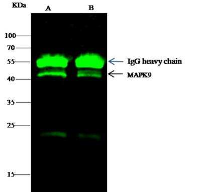 Immunoprecipitation: JNK2 Antibody (004) [NBP2-89620]