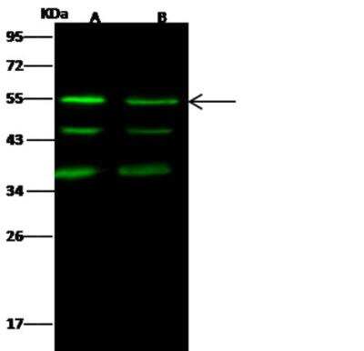 Western Blot: JNK2 Antibody (004) [NBP2-89620]