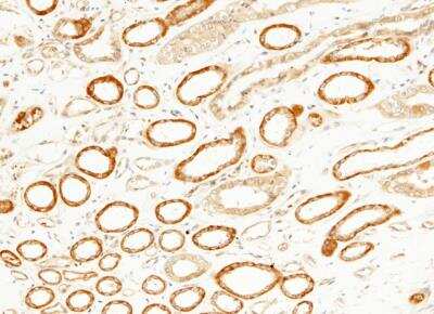 Immunohistochemistry-Paraffin: JNK2 Antibody (011) [NBP2-89621]
