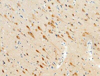 Immunohistochemistry-Paraffin: JNK2 Antibody (011) [NBP2-89621]