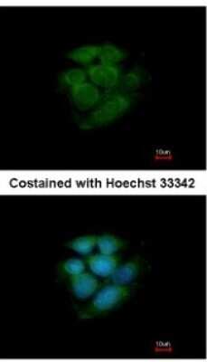 Immunocytochemistry/ Immunofluorescence: JNK2 Antibody [NBP1-30905]