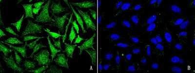 Immunocytochemistry/ Immunofluorescence: JNK2 Antibody [NBP2-98811]