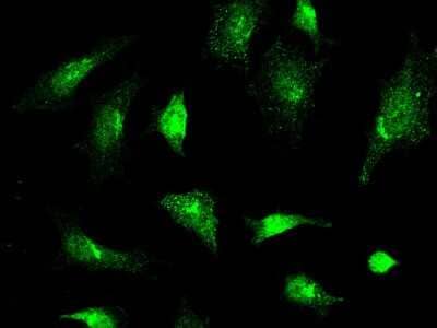 Immunocytochemistry/ Immunofluorescence: JNK2 Antibody [NBP2-98812]