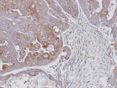 Immunohistochemistry-Paraffin: JNK2 Antibody [NBP1-30905]